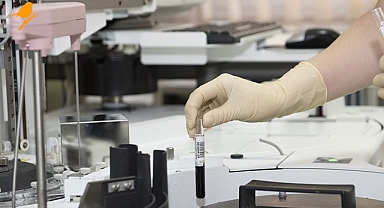 Önlisans Biyokimya bölümü mezunlarından çağrı: Atama bekliyoruz