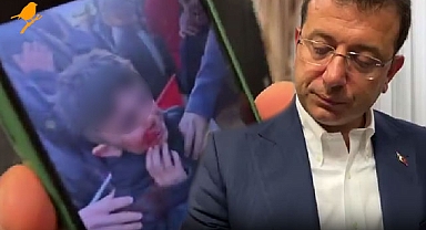 Ekrem İmamoğlu yaralanan küçük çocuğu paylaştı: Şu çocuğu polis koruyamadı
